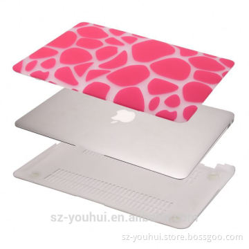New arrival accesories for Macbook